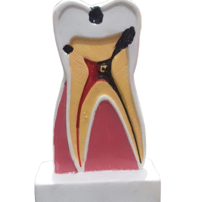 Picture of Fiber Model Teeth Dental