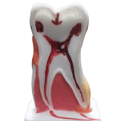 Picture of Dental Teeth Model Small-White