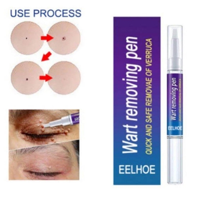 Picture of Eelhoe Doctor Proven Verruca & Wart Removing Pen