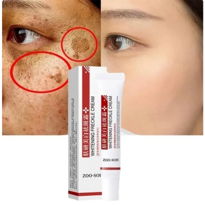 Picture of Zoo Son Whitening Freckle Cream