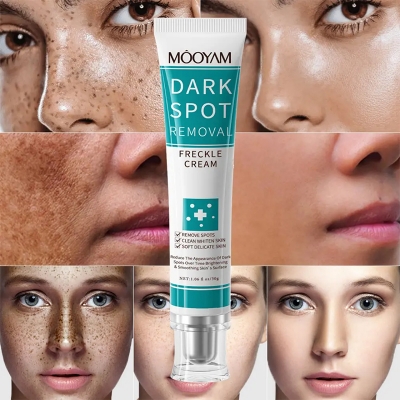 Picture of MOOYAM Dark Spot Removal Freckle Cream 30g