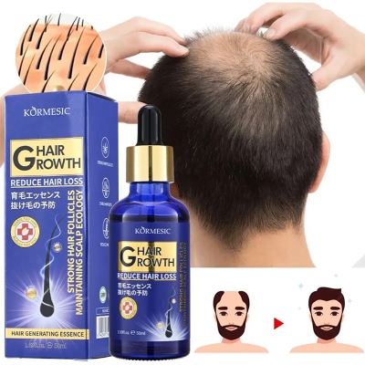 Picture of KÖRMESIC G Hair Growth Reduce Hair Loss Strong Hair Follicles Maintaining Scalp Ecology, 50ml