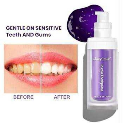 Picture of Smile Kit Purple Whitening Toothpaste – Instant Brightening Formula 30 ml 