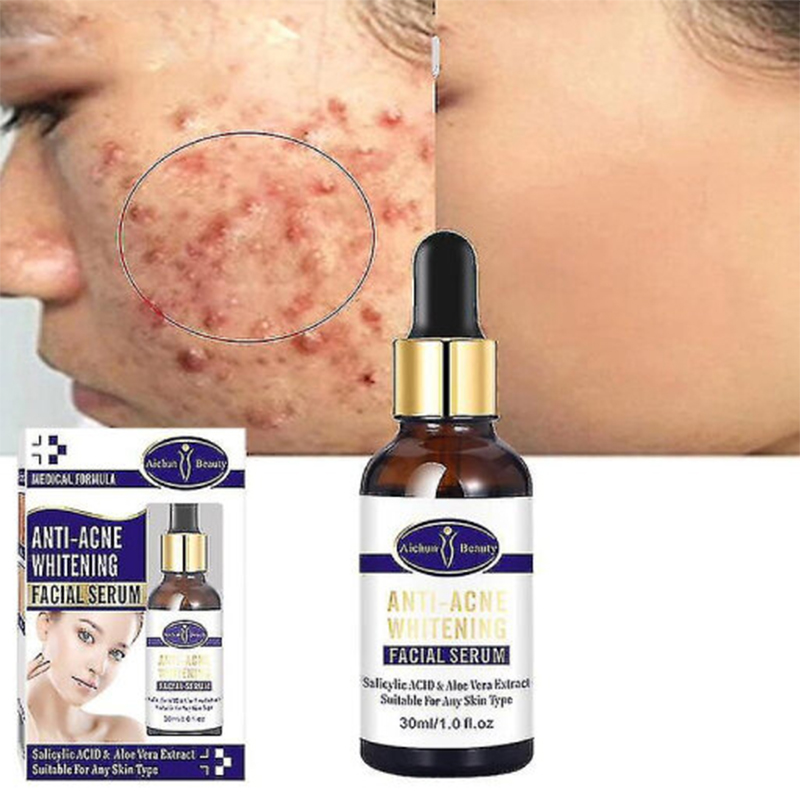 Picture of Aichun Beauty Anti Acne Whitening Facial Serum Dispels Acne Natural Organic Facial Oil Serum 30ml 