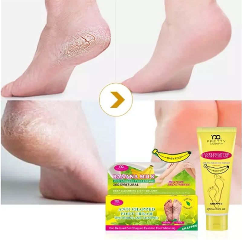 Picture of AICHUN BEAUTY Cracked Heel Cream Foot Care Banana Milk Cream Rough Dry Skin Baby Foot - 80g 