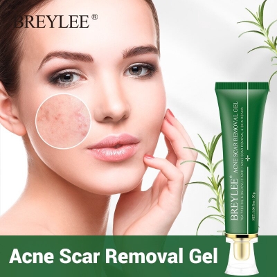 Picture of BREYLEE Acne Scar Removal Gel Fade Acne Marks Spots Remove Skin Pigmentation Soothing Prevent Acne Treatment Serum Essence -30gm 