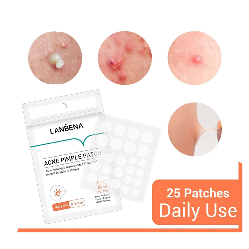 Picture of Lanbena Acne Pimple Patch - 25 Patches 