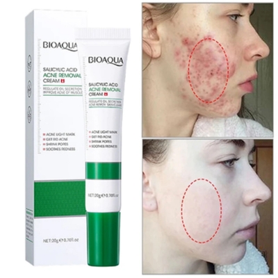 Picture of BIOAQUA Acne Removal Cream Anti Acne Treatment Repair Marks Moisturizing Blackhead Remover Facial Cream Skin Care-20gm 