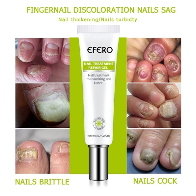 Picture of Nail Cream Treatment Repair Gel Moisturizing and Luster 