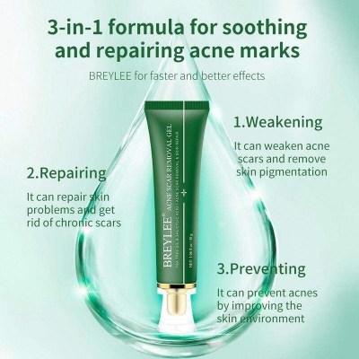Picture of BREYLEE Acne Scar Removal Gel Fade Acne Marks Spots Remove Skin Pigmentation Soothing Prevent Acne Treatment Serum Essence -30gm 