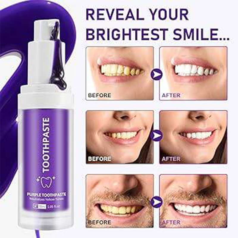 Picture of Smile Kit Purple Whitening Toothpaste – Instant Brightening Formula 30 ml 