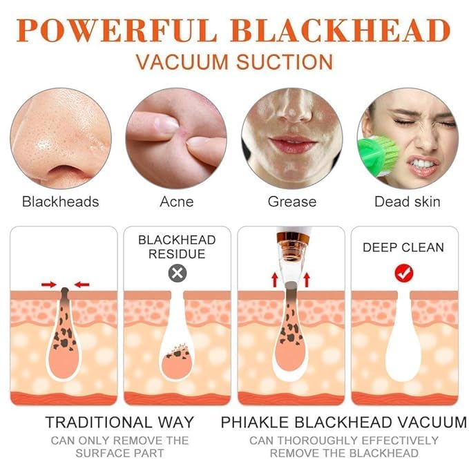 Picture of Multi-Functional Rechargeable Electric Blackhead Remover Cleaning Blackhead Device