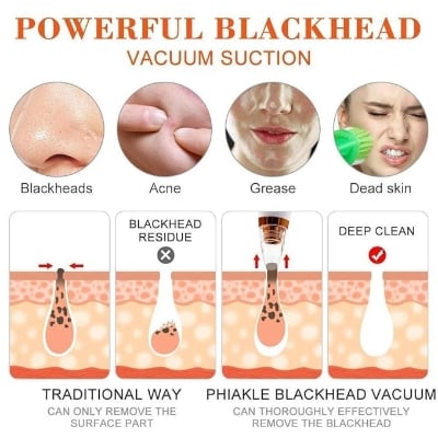 Picture of Multi-Functional Rechargeable Electric Blackhead Remover Cleaning Blackhead Device