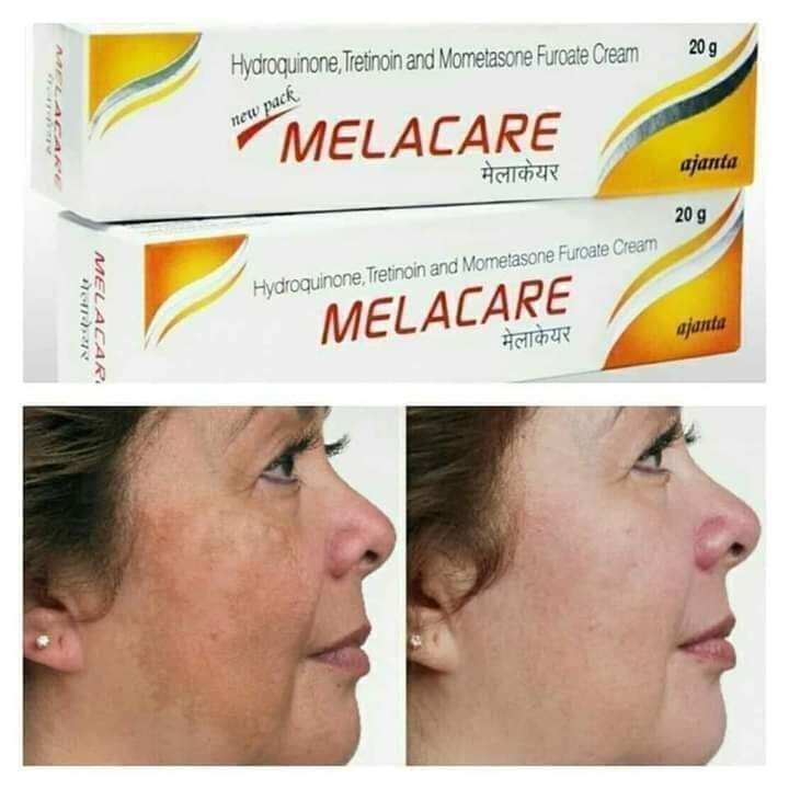 Picture of Melacare Cream 25g