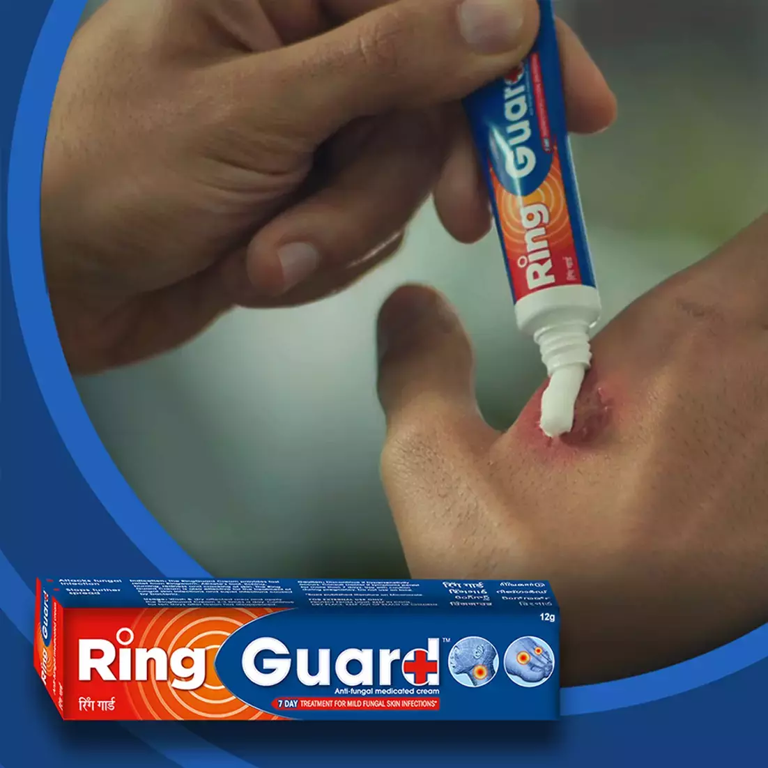 Picture of Ring Guard Anti Fungal Cream Tube Of 12g for Ringworm Treatment - Antifungal Care