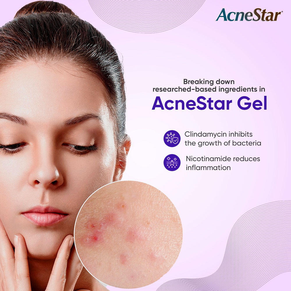 Picture of AcneStar Gel Cream For pimples - 22g For Acne, Pimples, Whiteheads And Blackheads