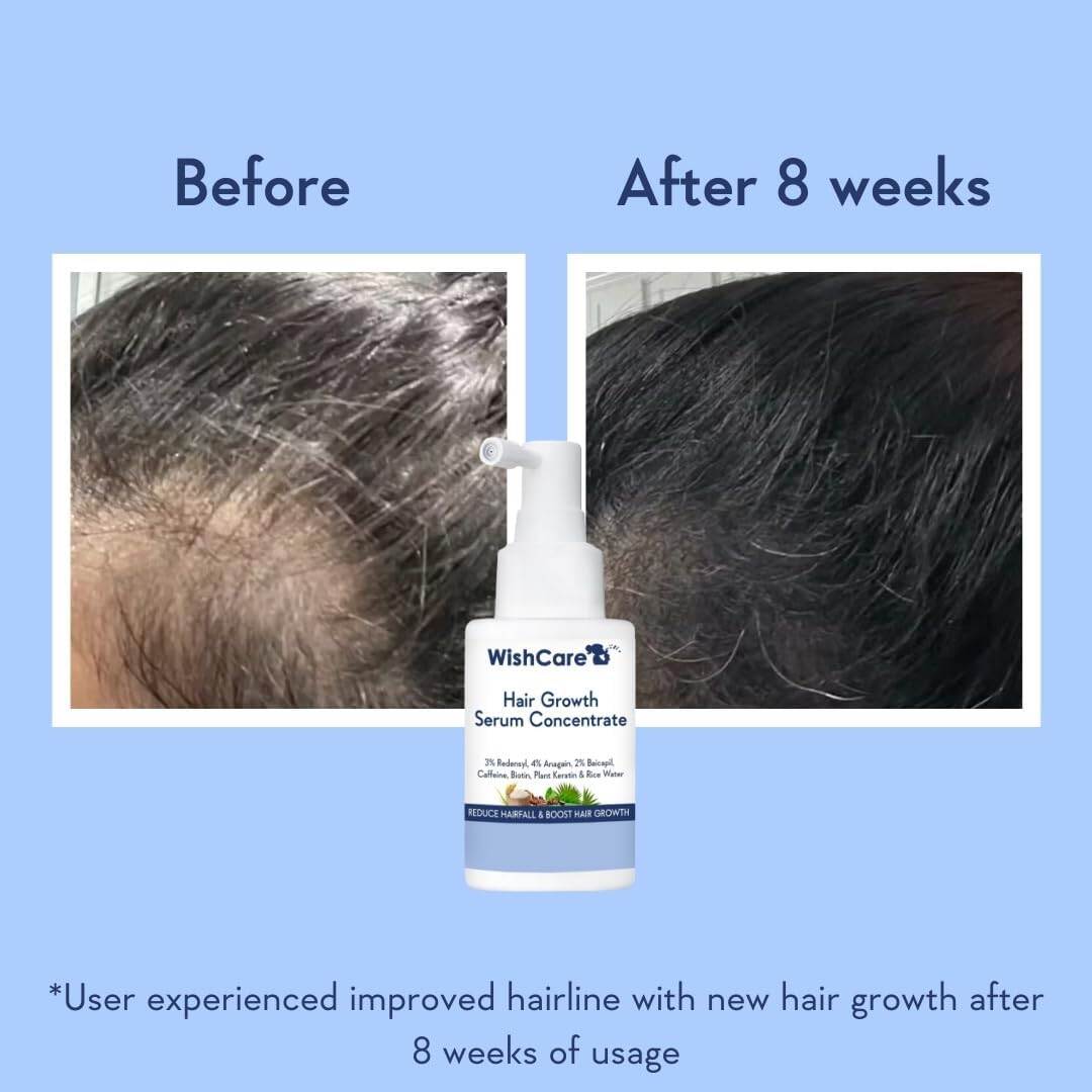 Picture of WishCare Hair Growth Serum Concentrate 30ml