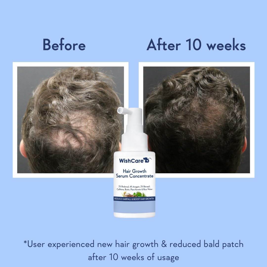 Picture of WishCare Hair Growth Serum Concentrate 30ml