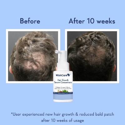 Picture of WishCare Hair Growth Serum Concentrate 30ml