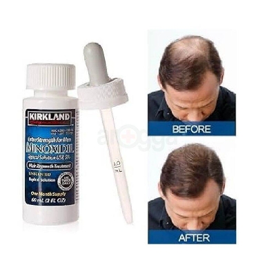Picture of Kirkland 5% Minoxidil Extra Strength Hair Loss & Hair Regrowth Treatment for Men 60ml