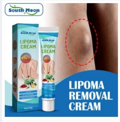 Picture of South Moon Lipoma Removal Cream Lipolysis Fat Lump Relieve Plaster Skin Swelling Ointment Subcutaneous Lumps Dredge Dissipate Body Care
