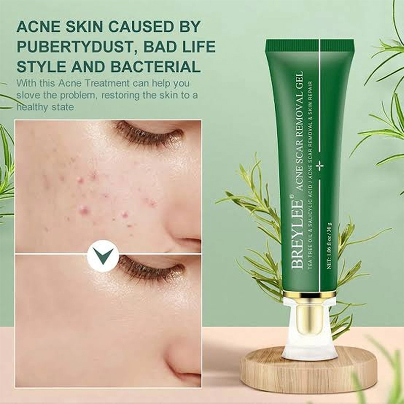 Picture of BREYLEE Acne Scars Removal For Face Tea Tree Acne Treatment Gel 
