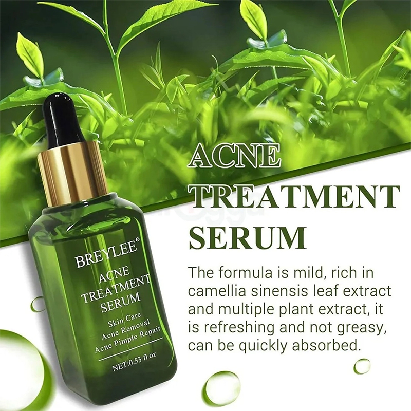 Picture of BREYLEE Acne Treatment Serum Face Facial Anti Acne Scar Removal Cream Skin Care Whitening Repair Pimple