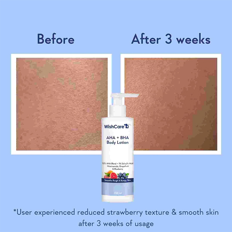 Picture of WishCare AHA + BHA Body Lotion | 200 ml