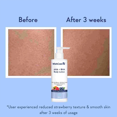 Picture of WishCare AHA + BHA Body Lotion | 200 ml