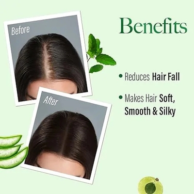 Picture of Kesh King Herbal Hairfall Shampoo 200 Ml Natural Hair Growth Treatment for Men And Women Hair Thickening And Regrowth Shampoo