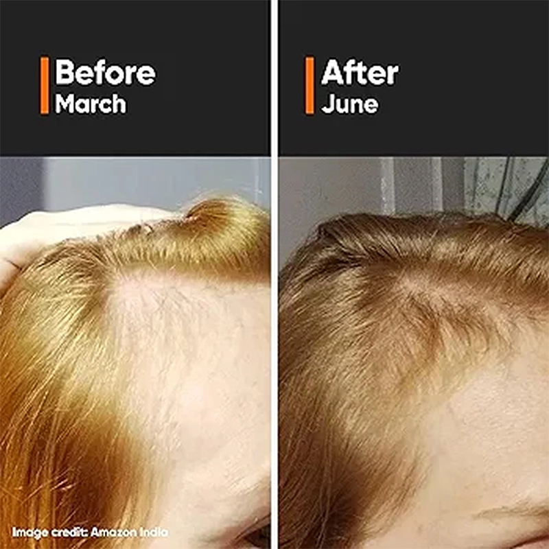 Picture of Minimalist Hair Growth Actives 18% Hair Serum-30ml