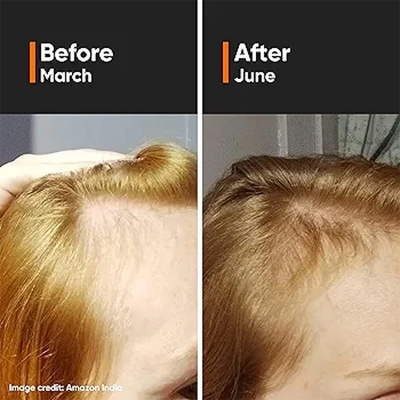Picture of Minimalist Hair Growth Actives 18% Hair Serum-30ml