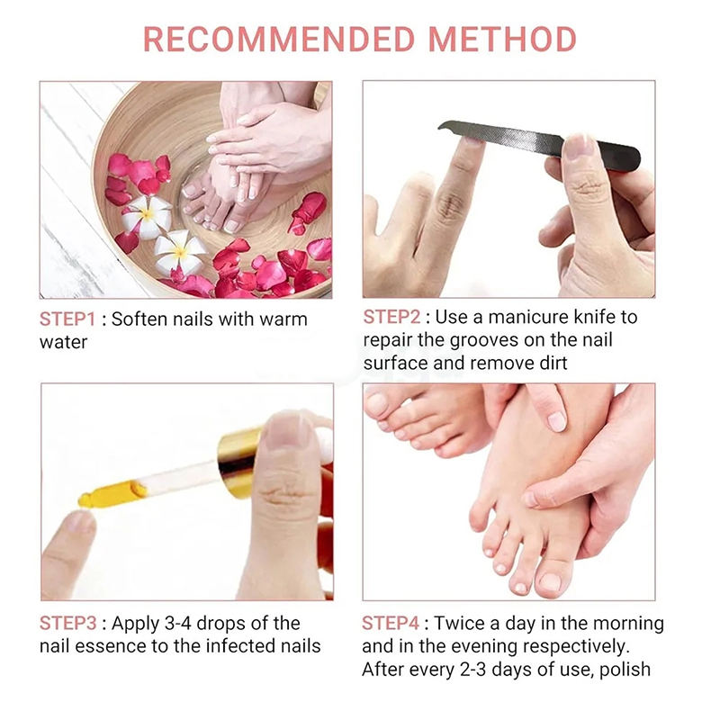 Picture of LANBENA Nail Repair Essence 15ml
