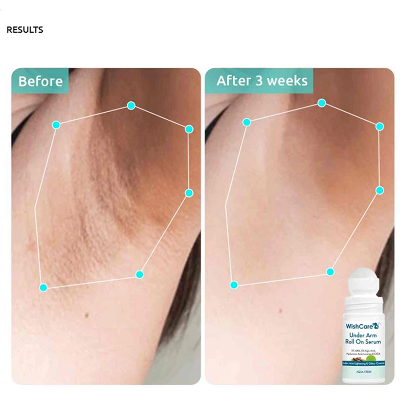 Picture of WishCare Under Arm Roll On Serum – 50ml