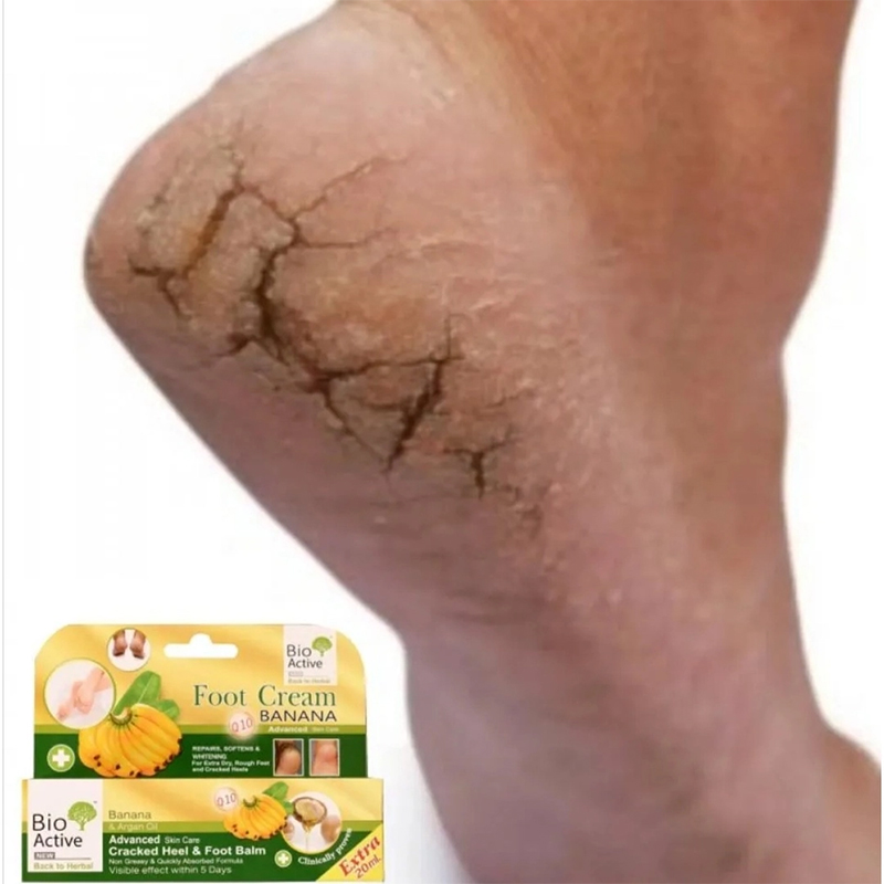 Picture of Bio Active Banana & Argan Oil Cracked Heel & Foot Balm - 30ml