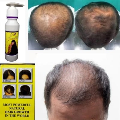 Picture of Zafran Hair Growth Oil (Original Pakistani) - 150Ml