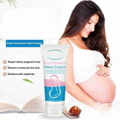 Picture of Aichun Beauty Anti Stretch Mark Cream – Intensive Skin Treatment