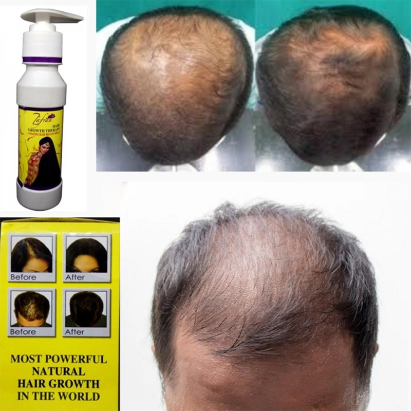 Picture of Zafran Hair Growth Oil (Original Pakistani) - 150Ml
