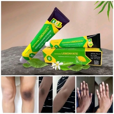 Picture of Lemonvate Skin Brightening Cream - 30Gm