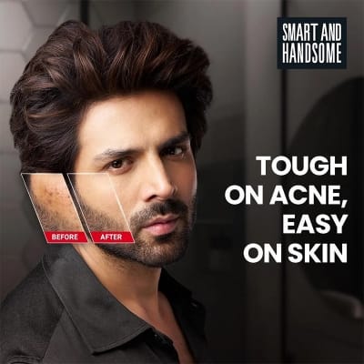 Picture of Emami Smart And Handsome Acnefix Xpert Face Wash 100Gm