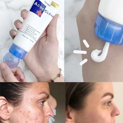 Picture of Mistine Acne Clear Face Wash (Thailand) - 85Gm