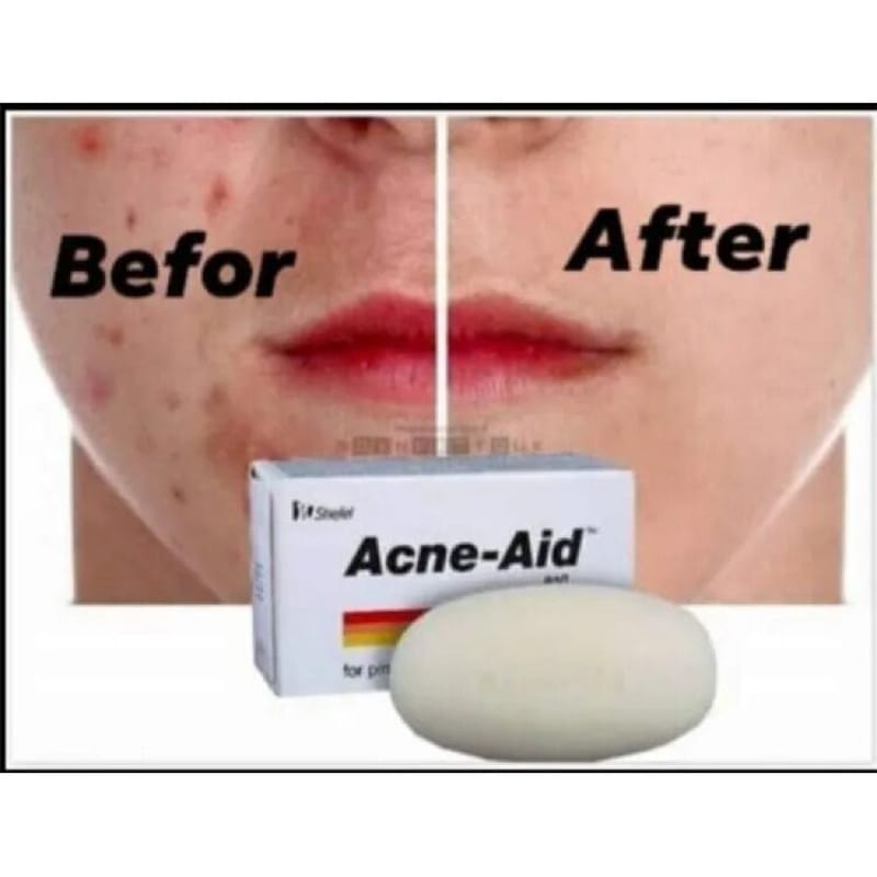 Picture of Stiefel Acne-Aid Bar 100g Pimple Prone & Oily Skin Acne Aid Soap