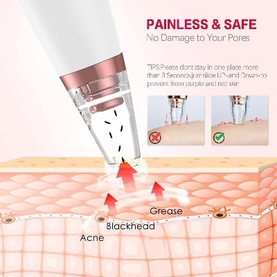 Picture of Electric Vacuum Electric Acne / Blackhead Remover Extractor 6 Suction Head Beauty Machine For Skin Care