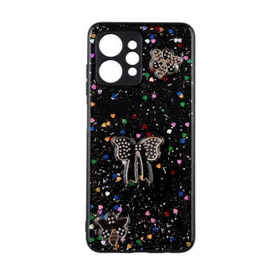 Picture of Xundu Stylish Case For Motorola Edge 20 - Luxury Raised Edges Protect Camera And Screen Xundd Shockproof Transparent - Durable And Reliable - Clear - Phone Back Cover Black