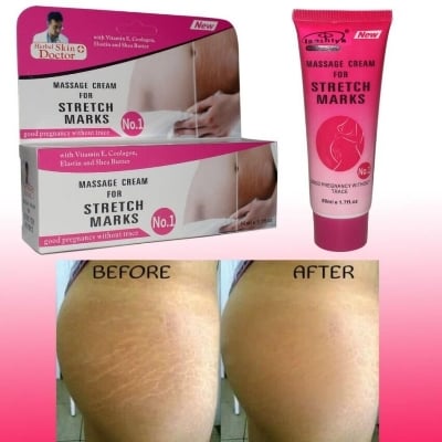 Picture of Herbal Skin Doctor Massage Cream for Stretch Marks – 50ml