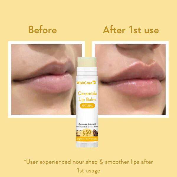 Picture of WishCare Ceramide Lip Balm with SPF 50 PA+++ (Natural)