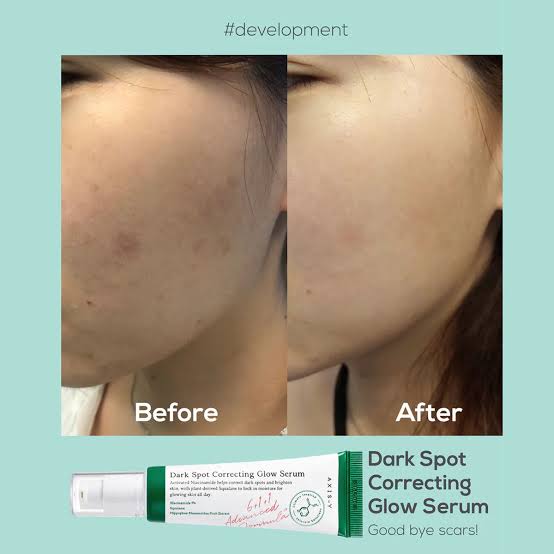Picture of AXIS-Y Dark Spot Correcting Glow Serum 5ml