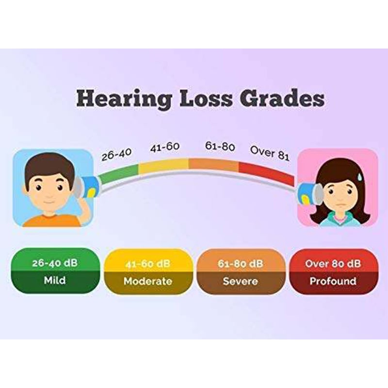 Picture of Rionet Hill Light Hearing Amplifier / Bte Hearing Aid Machine (Base) Sound Amplifier / Ear Hearing Machine / For Older Age with 1 year Warranty Made in Japan Battery