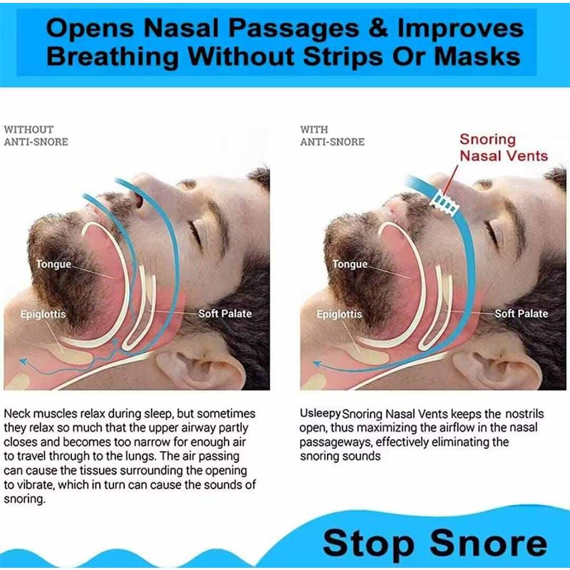 Picture of 8pcs Anti Snoring Nose Vents Device That Work, Anti Nose Vents for Snoring Devices, Snoring Devices for Men, Nose Opener for Breathing Sleep, Stop Snoring Devices That Work for Men