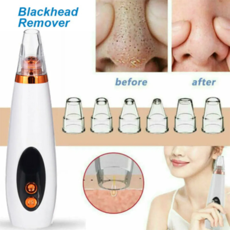 Picture of Blackhead Remover Machine Blackhead Remover Instrument Black Dot Remover Acne Vacuum Suction Face Clean Black Head Pore Cleaning Beauty Skin